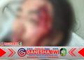 Waspada Pembegalan di Jalan Sepi! Wanita dan Anaknya Jadi Korban di Dusun Kalisepanjang Waspada Pembegalan di Jalan Sepi! Wanita dan Anaknya Jadi Korban di Dusun Kalisepanjang