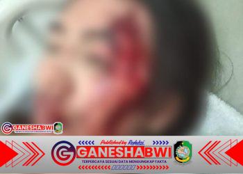 Waspada Pembegalan di Jalan Sepi! Wanita dan Anaknya Jadi Korban di Dusun Kalisepanjang