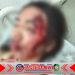 Waspada Pembegalan di Jalan Sepi! Wanita dan Anaknya Jadi Korban di Dusun Kalisepanjang Waspada Pembegalan di Jalan Sepi! Wanita dan Anaknya Jadi Korban di Dusun Kalisepanjang