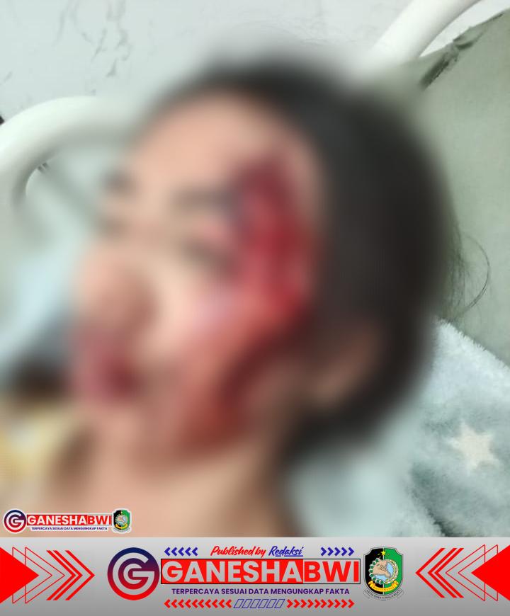 Waspada Pembegalan di Jalan Sepi! Wanita dan Anaknya Jadi Korban di Dusun Kalisepanjang Waspada Pembegalan di Jalan Sepi! Wanita dan Anaknya Jadi Korban di Dusun Kalisepanjang